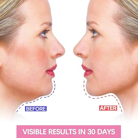 Darziq V Shape Face Slimming Strap for facial contouring and toning in a health and beauty setting.